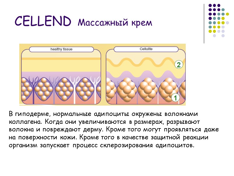В гиподерме, нормальные адипоциты окружены волокнами коллагена. Когда они увеличиваются в размерах, разрывают волокна